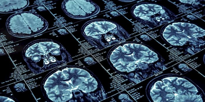 Department of Neurology Gift Fund