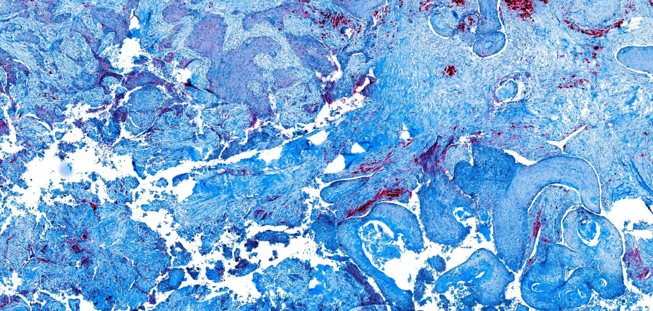Dermatology Gift Fund